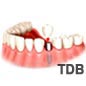 dental implant ��Ż ���ö�Ʈ