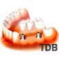 dental implant bridges, 2 ���ö�Ʈ + 3 ũ���