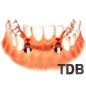 dental implant bridges, 2 ���ö�Ʈ + 4 ũ���