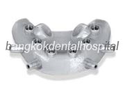 Implant NobelGuide Zygoma �뺧���̵� ���ư��� ���ö�Ʈ