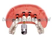 Implant NobelGuide Zygoma �뺧���̵� ���ư��� ���ö�Ʈ